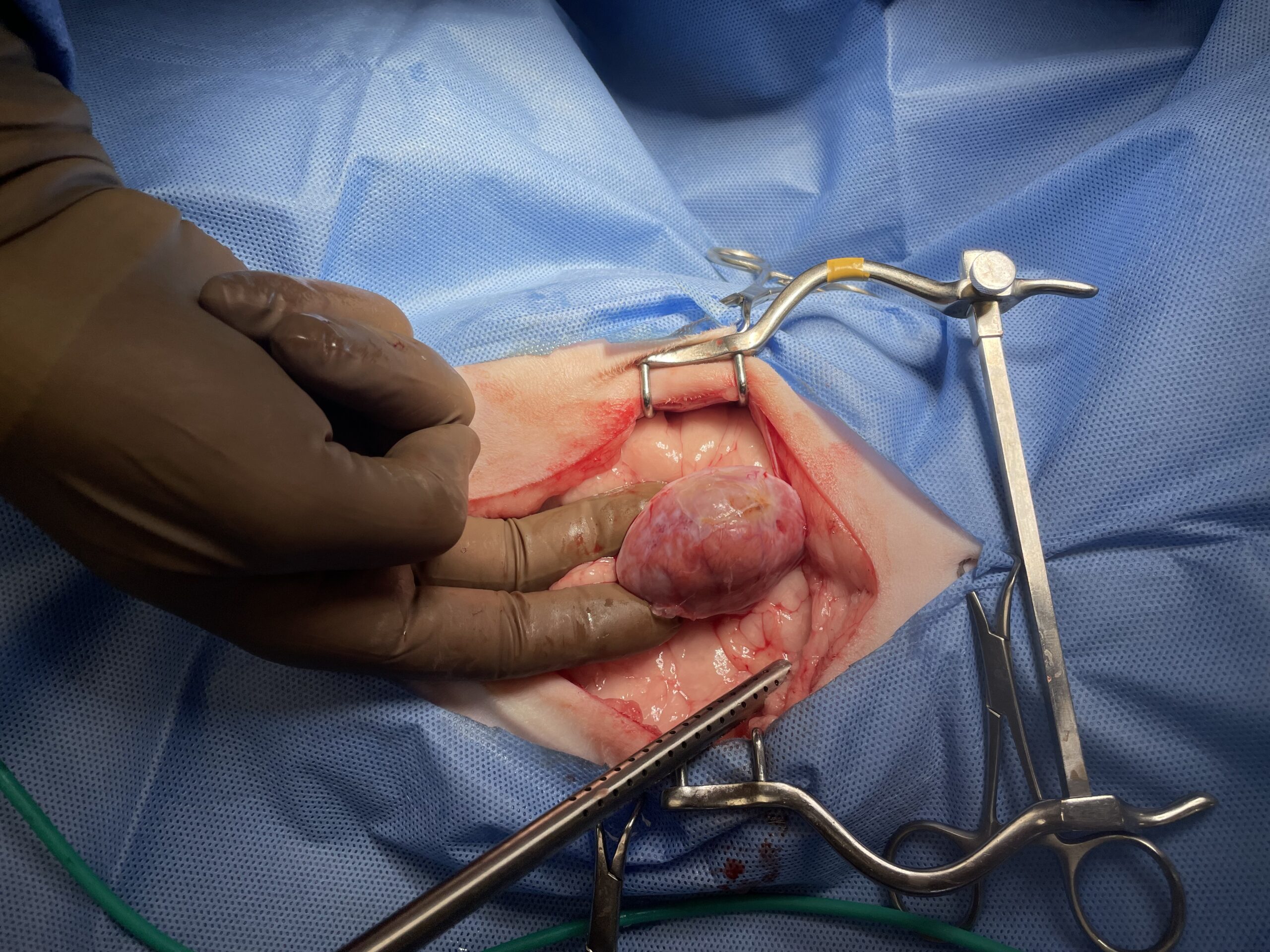 Taz intraop 2 Taz intraop 2