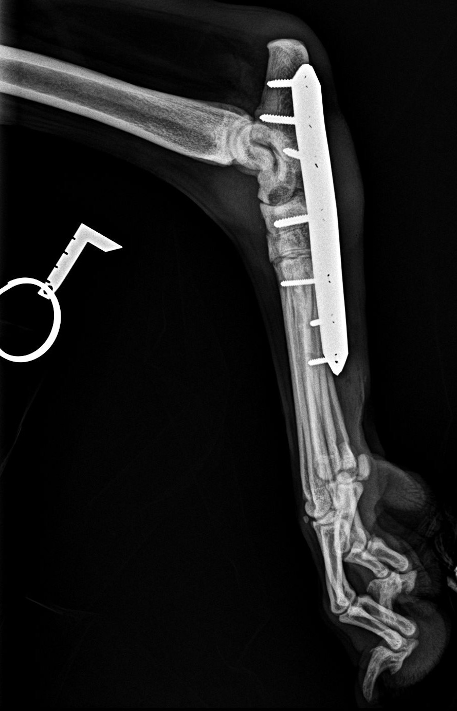 Postop X ray